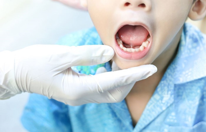 Qu'est-ce que la paresthésie dentaire, et comment la traiter ?